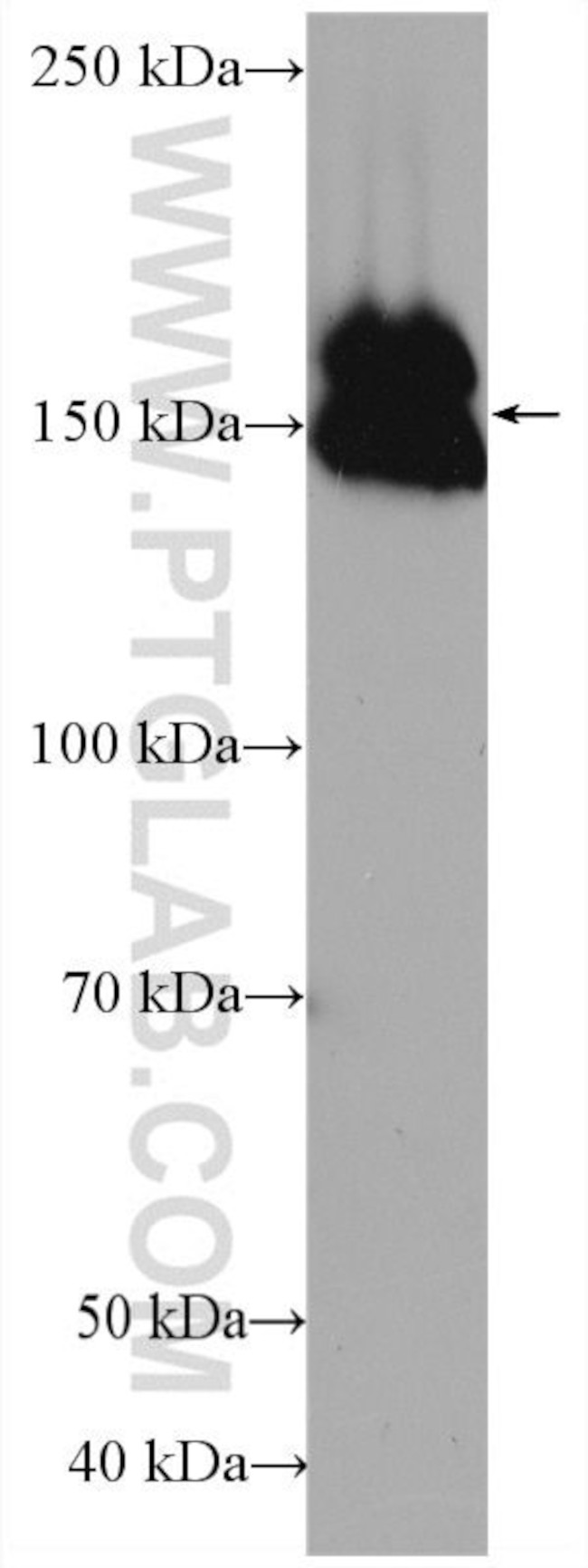 Collagen Type III Antibody in Western Blot (WB)