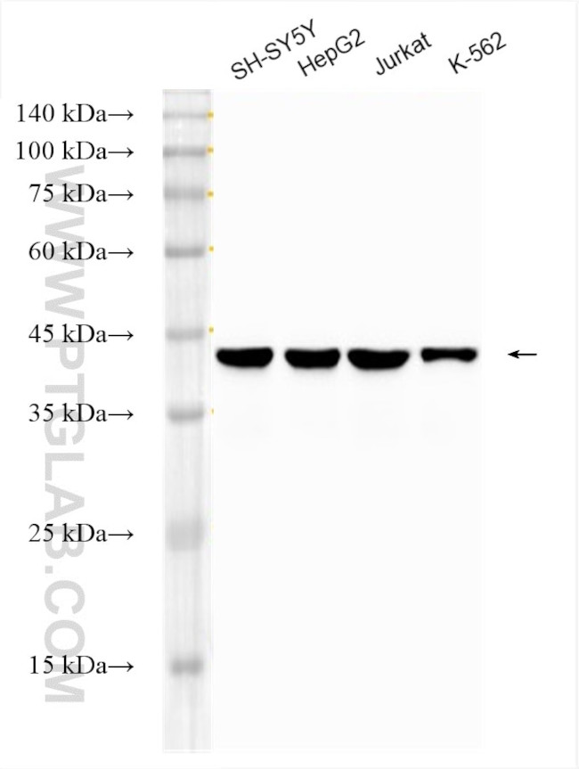 TDP-43 Antibody in Western Blot (WB)