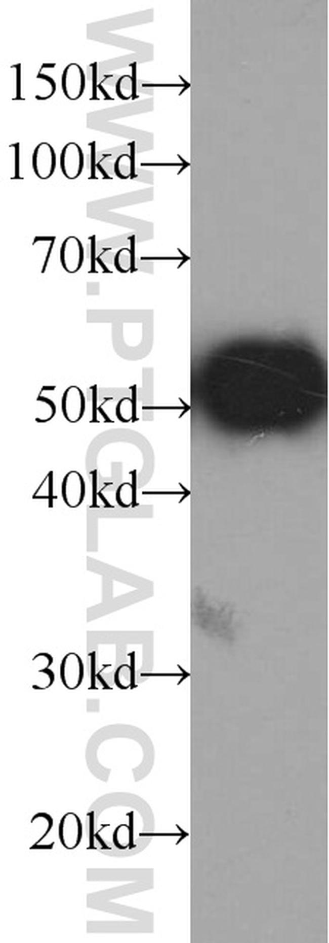 GFP tag Antibody in Western Blot (WB)