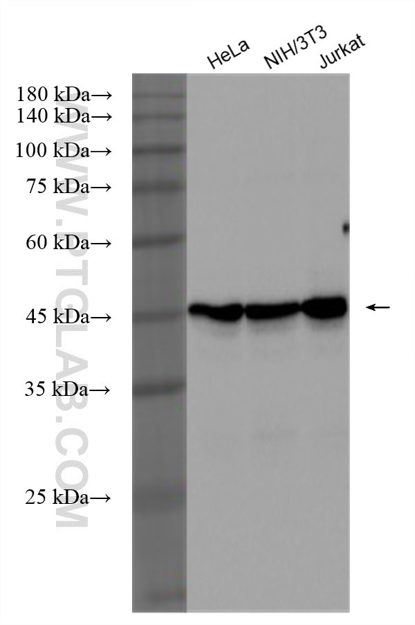 IgM Antibody in Western Blot (WB)