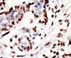 HRX Antibody in Immunohistochemistry (IHC)