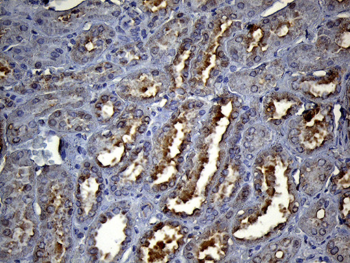HS1BP3 Antibody in Immunohistochemistry (Paraffin) (IHC (P))