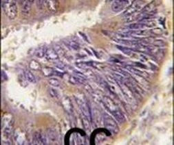 HIP Antibody in Immunohistochemistry (IHC)