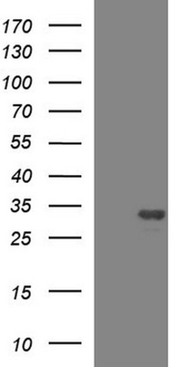 HSCB Antibody in Western Blot (WB)