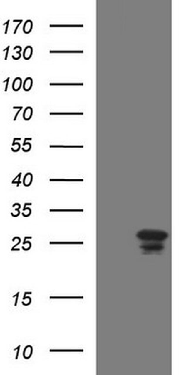 HSCB Antibody in Western Blot (WB)