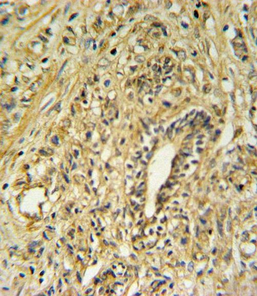 HSD17B2 Antibody in Immunohistochemistry (IHC)