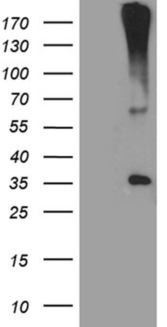 HSD17B3 Antibody in Western Blot (WB)