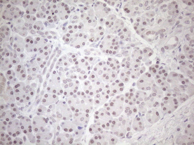 HSF2 Antibody in Immunohistochemistry (Paraffin) (IHC (P))
