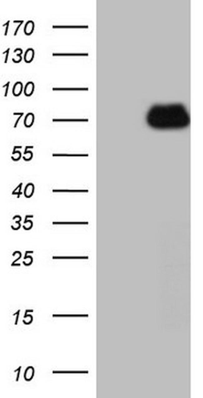 HSF2 Antibody in Western Blot (WB)