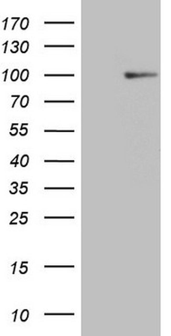 HSF2 Antibody in Western Blot (WB)