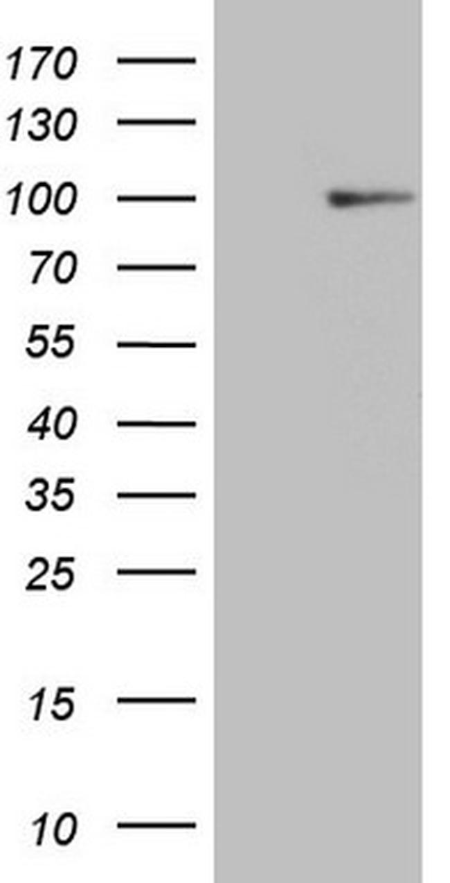 HSF2 Antibody in Western Blot (WB)