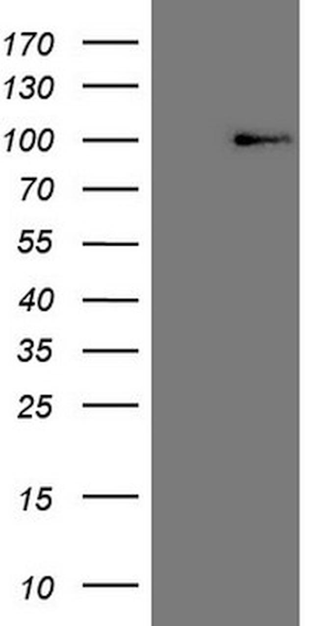 HSF2 Antibody in Western Blot (WB)