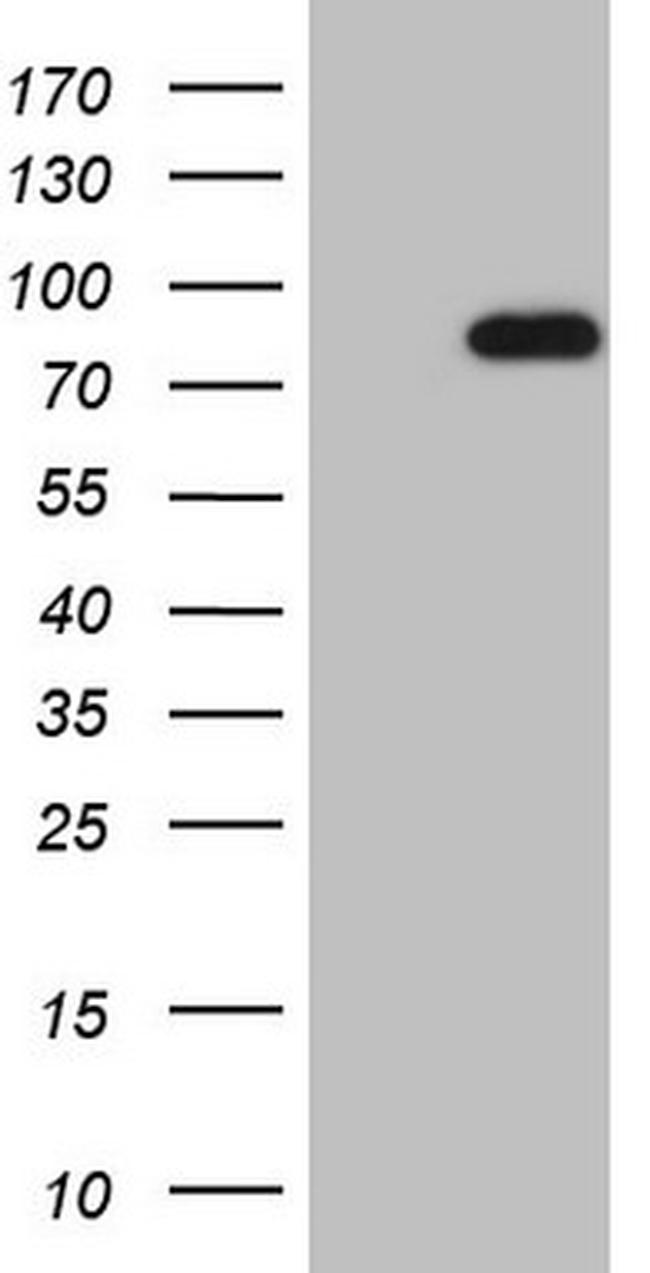 HSF2 Antibody in Western Blot (WB)