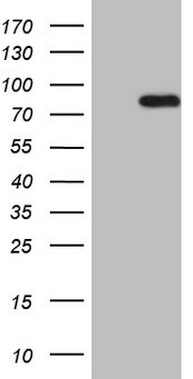 HSF2 Antibody in Western Blot (WB)