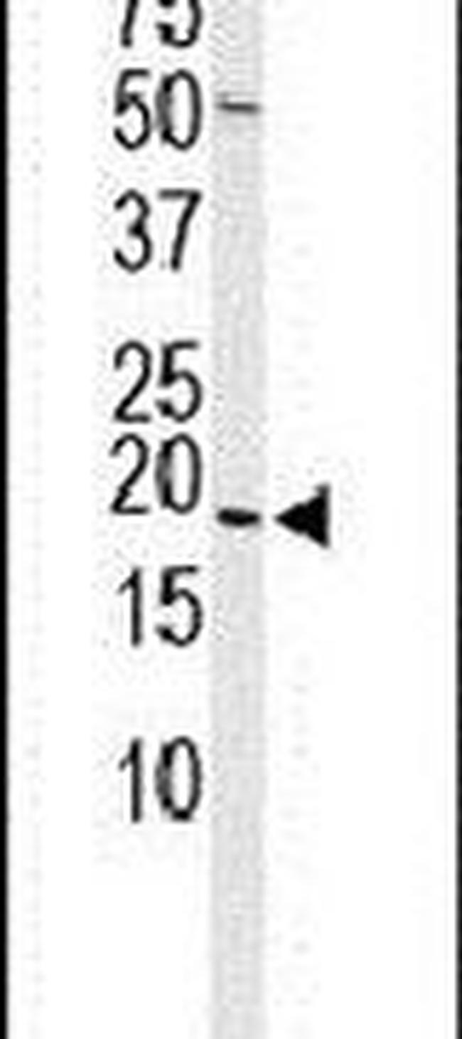 HSP20 Antibody in Western Blot (WB)
