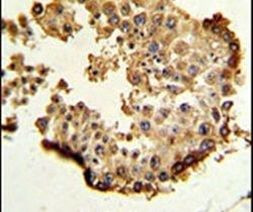 HSP90 beta Antibody in Immunohistochemistry (IHC)