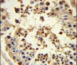 HSP90 beta Antibody in Immunohistochemistry (IHC)