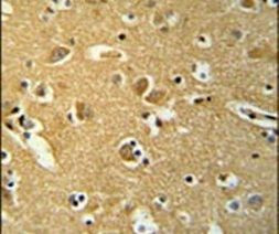 BABAM1 Antibody in Immunohistochemistry (IHC)