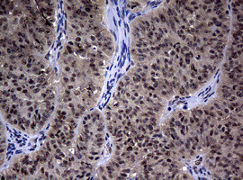 Hsp60 (HSPD1) Antibody in Immunohistochemistry (Paraffin) (IHC (P))