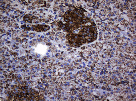 Hsp60 (HSPD1) Antibody in Immunohistochemistry (Paraffin) (IHC (P))