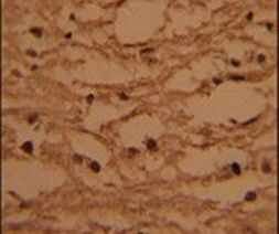 HTATSF1 Antibody in Immunohistochemistry (IHC)