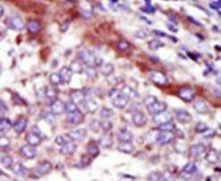 HUNK Antibody in Immunohistochemistry (IHC)
