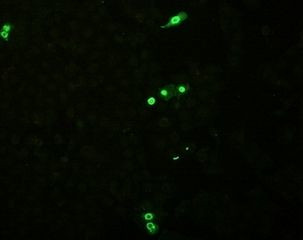 Influenza B NP Antibody in Immunocytochemistry (ICC/IF)