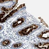 NGAL Antibody in Immunohistochemistry (IHC)