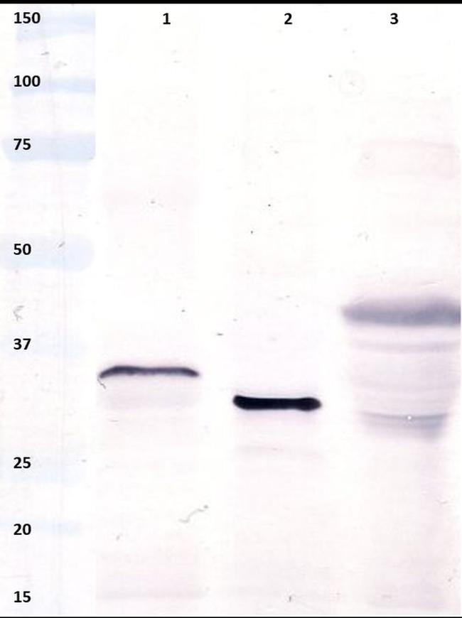 Gliadin Antibody in Western Blot (WB)