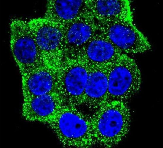 TSC1 Antibody in Immunocytochemistry (ICC/IF)