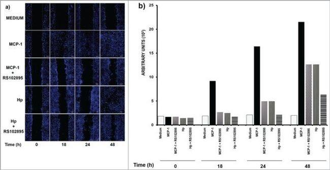 Haptoglobin Antibody in Immunocytochemistry (ICC/IF)