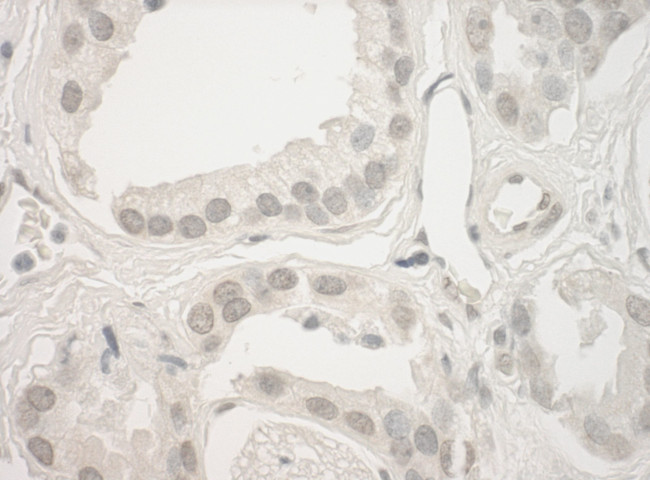 Haspin Antibody in Immunohistochemistry (IHC)