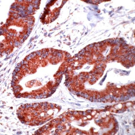 HSP60 Antibody in Immunohistochemistry (IHC)