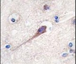 Hippocalcin Antibody in Immunohistochemistry (IHC)