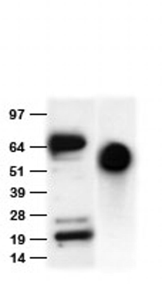 His tag Antibody in Western Blot (WB)
