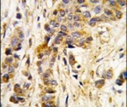 IARS2 Antibody in Immunohistochemistry (IHC)