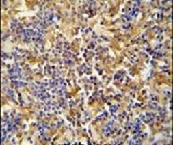 IBTK Antibody in Immunohistochemistry (IHC)