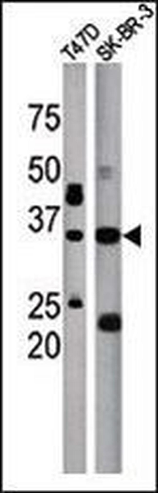 ICMT Antibody in Western Blot (WB)
