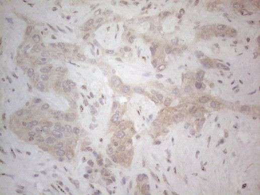 ICOSLG Antibody in Immunohistochemistry (Paraffin) (IHC (P))