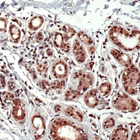 ID2 Antibody in Immunohistochemistry (IHC)