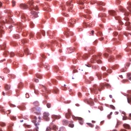 ID3 Antibody in Immunohistochemistry (IHC)