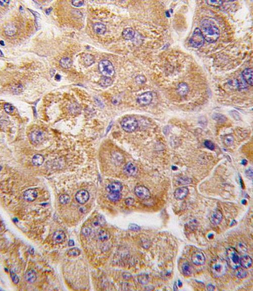 IDE Antibody in Immunohistochemistry (IHC)