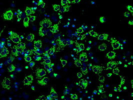 IDH3A Antibody in Immunocytochemistry (ICC/IF)