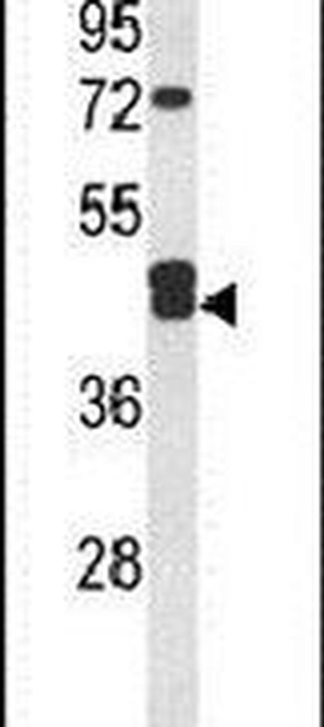 IDH3G Antibody in Western Blot (WB)