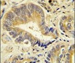IDUA Antibody in Immunohistochemistry (IHC)