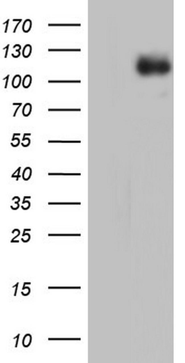IFIH1 Antibody in Western Blot (WB)
