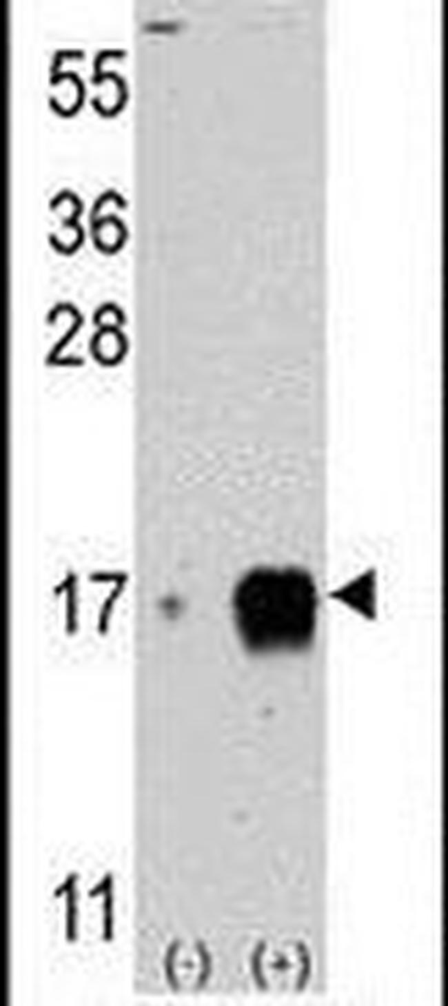 IFITM3 Antibody in Western Blot (WB)