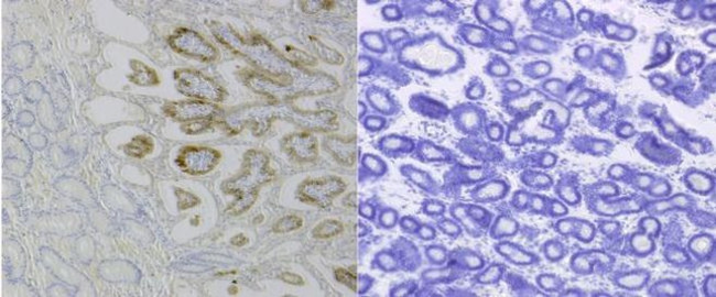 IFN epsilon Antibody in Immunohistochemistry (Paraffin) (IHC (P))