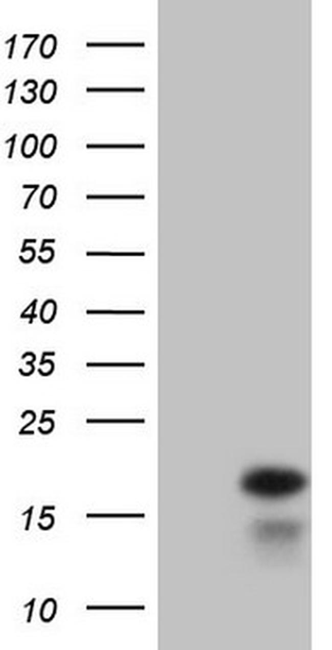 IFNG Antibody in Western Blot (WB)