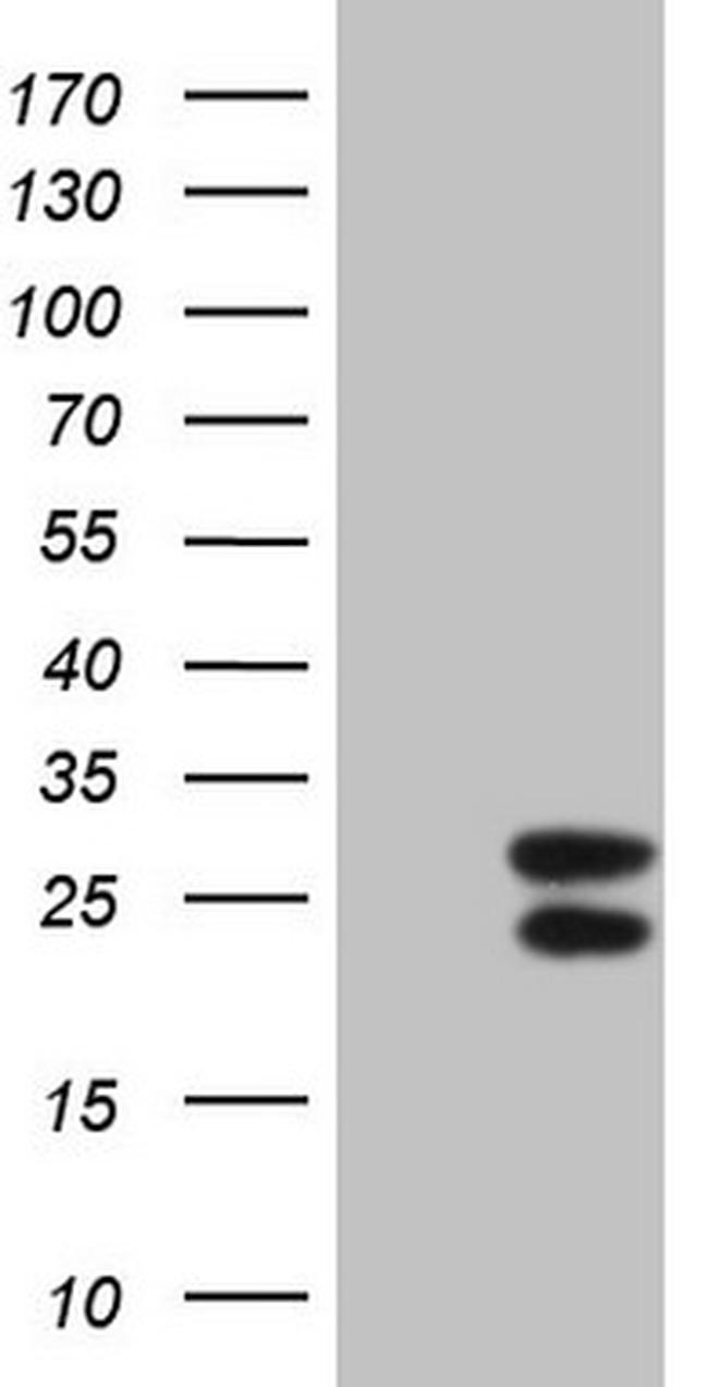 IFNG Antibody in Western Blot (WB)